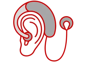 What is a cochlear implant at C.C. Saha Ltd.