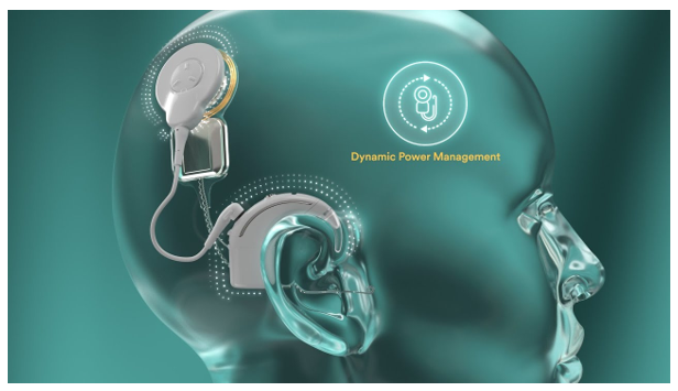 Cochlear Smart Nexa System with dynamic power management CC Saha Ltd.